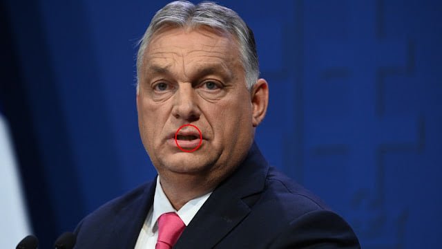 ALIG pár perce érkezett! Nagyon aggódnak az emberek! Orbán Viktor EBBEN a súlyos betegségben szenved? Megszólalt egy orvos is. Ez a nagyon veszélyes folt van a száján már hosszú ideje..