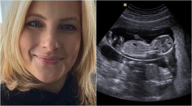 MOST ÉRKEZETT! Várkonyi Andi eloszlatta a pletykákat és bejelentette a hírt. EZ most váratlanul ért mindenkit: